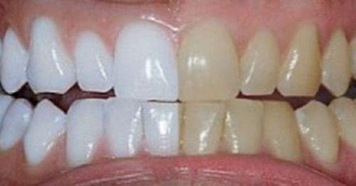 Voici comment blanchir ses dents naturellement
