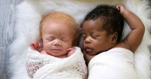 Mère donne naissance à des jumeaux noirs et blancs et leur apprend à apprécier leurs différences