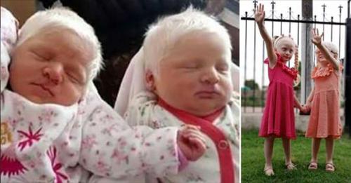 Une maman donne naissance à de rares jumelles albinos aux cheveux blancs comme de la neige