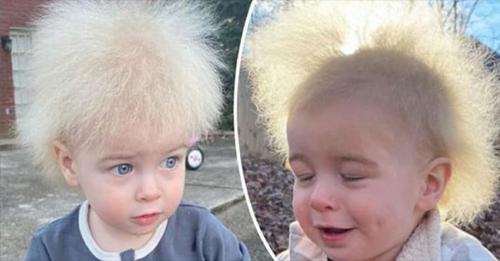 Un jeune enfant atteint du syndrome extrêmement rare des cheveux incoiffables fait sourire les gens